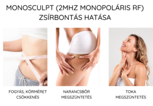 BBS-121 hatás, zsírpárnák